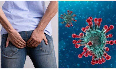 Covid-19 : le syndrome de ‘l’anus sans repos’, nouvel effet secondaire du virus
