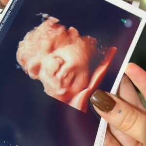 Nabilla, enceinte : elle montre le visage de son 2ème bébé