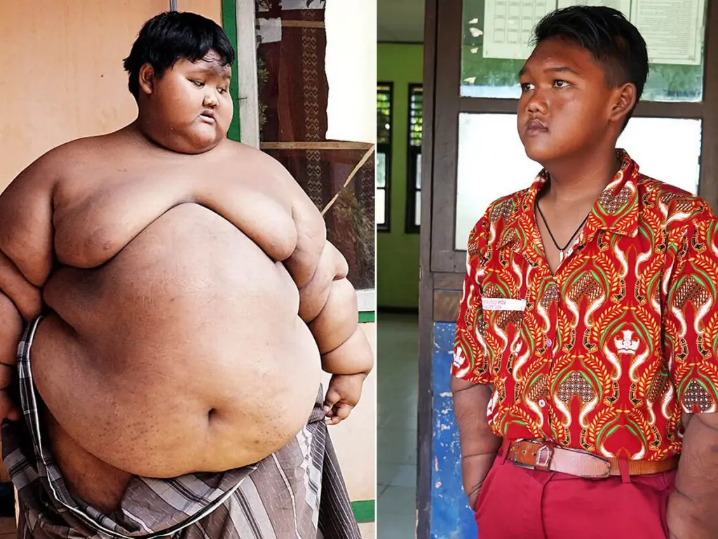 L’incroyable transformation du garçon le plus gros du monde (photos)
